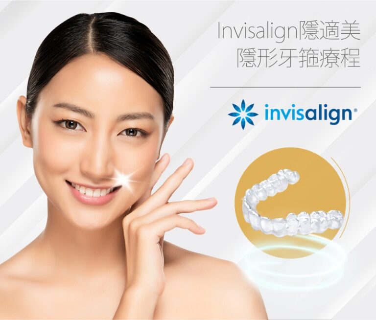 Invisalign隱適美隱形牙箍療程