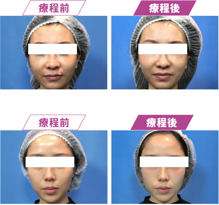 CMD 熱瑪槍真人實例