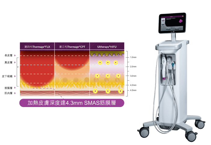 Thermage Flx 效能 Thermage Flx 儀器