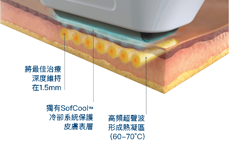 嶄新拉提方案