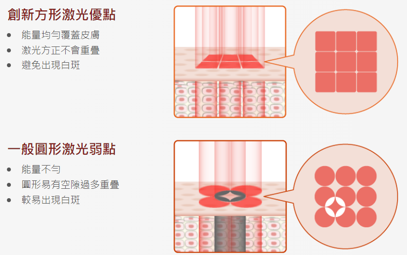 方形光束激光優點