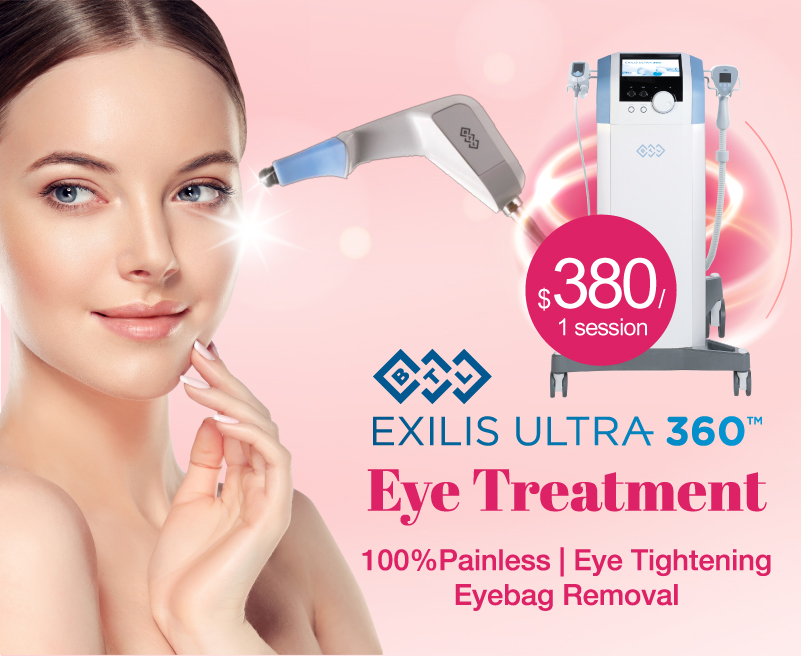 BTL Exilis Ultra 360 Eye Treatment